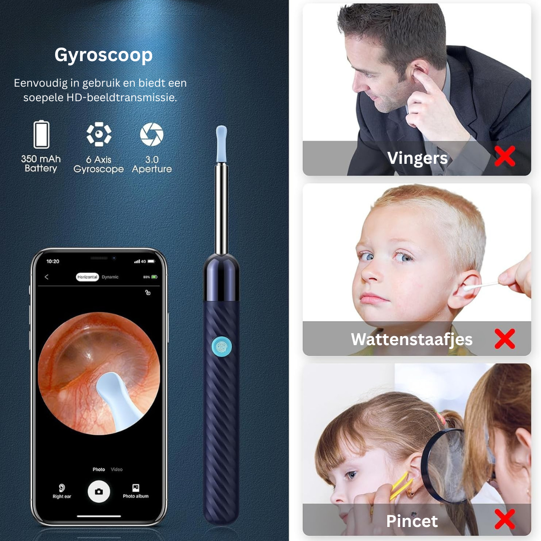 ClearEar Pro™ – Ohrenschmalz Entferner mit Kamera